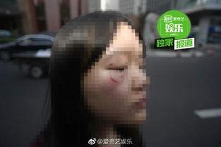女记者事件吃瓜,揭秘背后真相，吃瓜群众热议不断